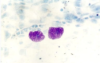 Mastociti