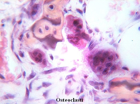 Osteoclasti