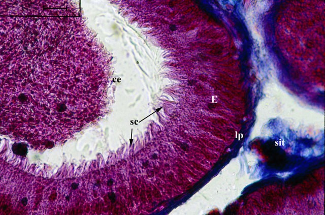 Epitelio del canale dell’epididimo