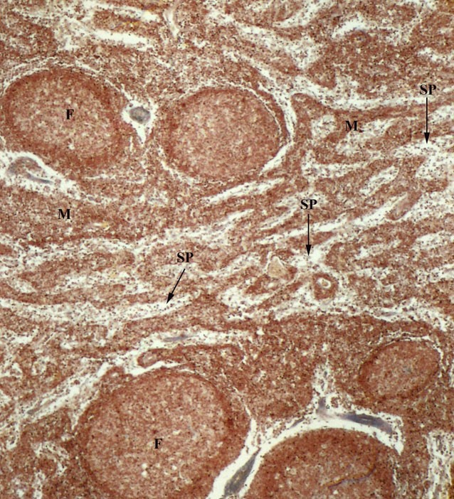 Parenchima linfonodale