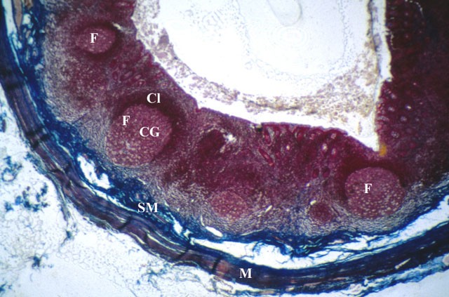 Struttura dell’appendice vermiforme