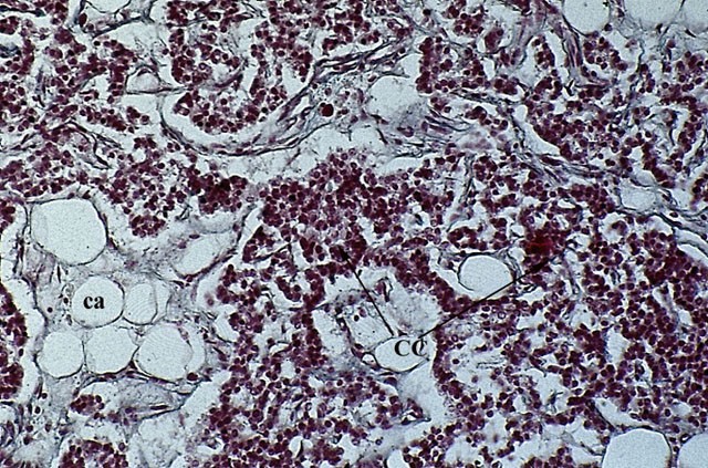 Cellule principali e cellule ossifile delle paratiroidi