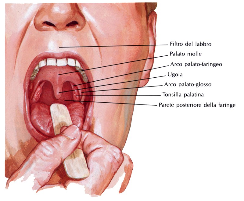 Tonsilla palatina