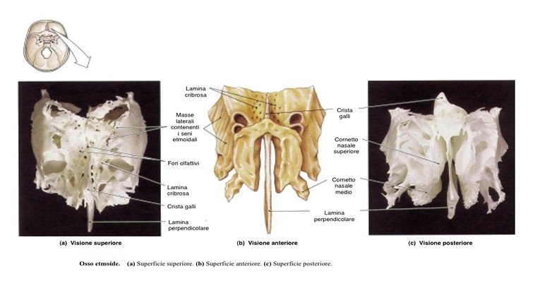 Facce superiore, anteriore e posteriore dell'osso etmoide