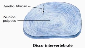 Disco intervertebrale