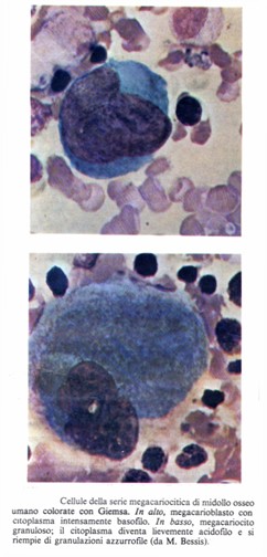 Cellule della serie megacariocitaria