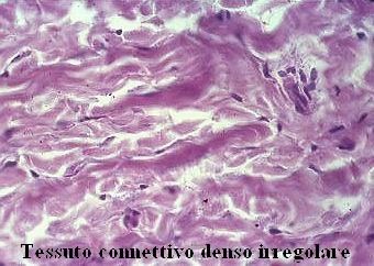 Tessuto connettivo denso (o compatto) irregolare