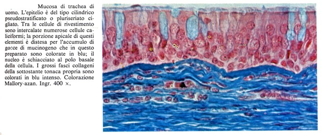 Epitelio pseudostratificato o pluriseriato ciliato di trachea