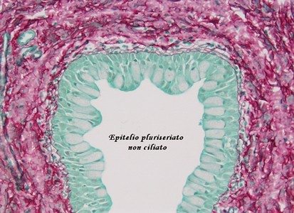 Epitelio pseudostratificato o pluriseriato non ciliato